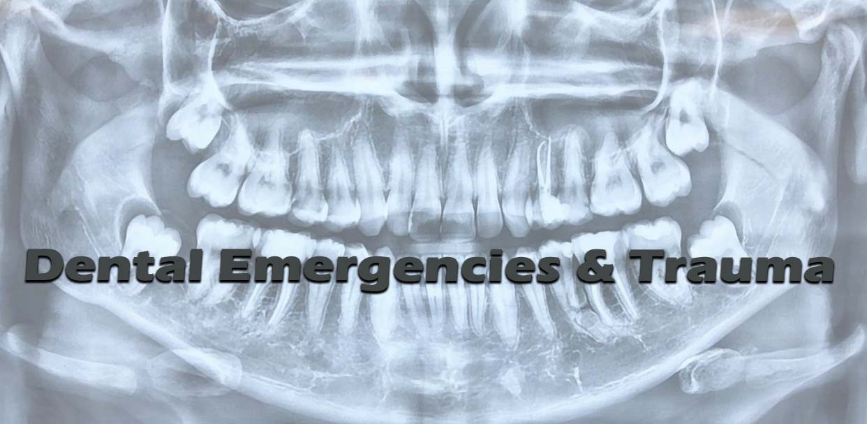 Dental Emergencies & Trauma